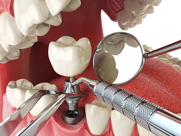 Best Emergency Treatment for Toothache in Oakland, OK